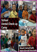 School Dental Check up Camp