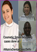 Cosmetic Smile Designing cases done at Matrix Clinic Delhi