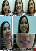 Afghanistan blast victim rehabilitated at Matrix Dental Clinic Delhi